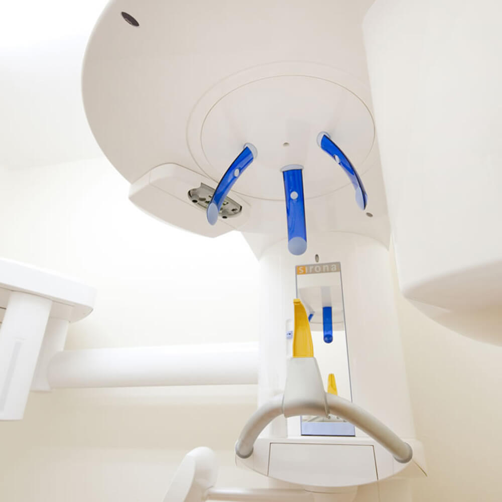 低線量デジタルレントゲン